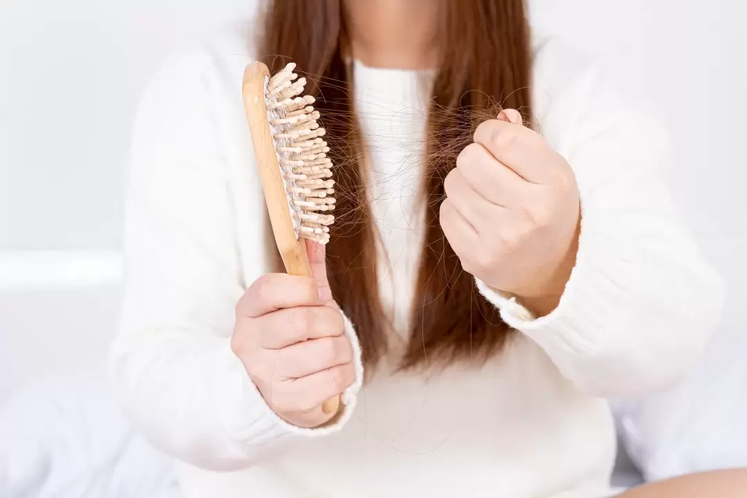 Perte de cheveux et traitement avec un pulvérisation de dés-parole